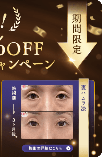 裏ハムラ法 キャンペーン