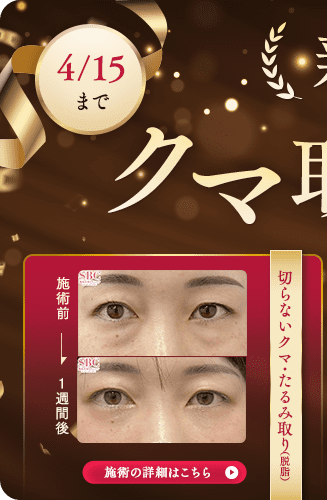 目の下の切らないクマ取り・たるみ(ふくらみ)取り キャンペーン