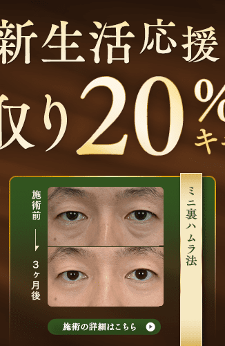 ミニ裏ハムラ法 キャンペーン