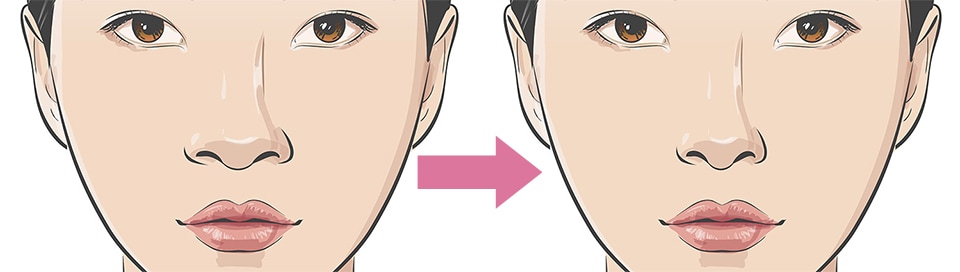 小鼻による表情の違い