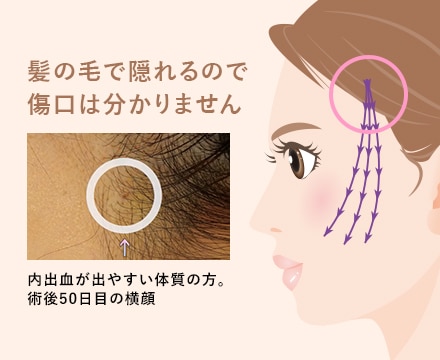 テスリフトがオススメの理由4