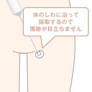 脂肪を採取 イメージ