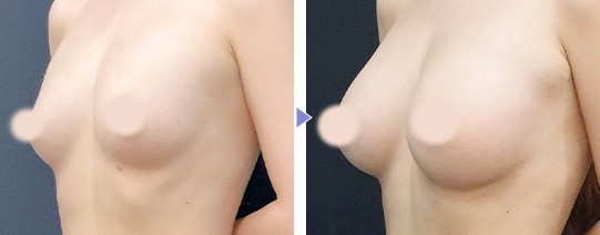 Motivaエルゴノミックス2 症例写真