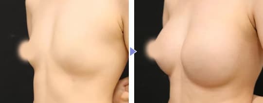 Motivaエルゴノミックス2 症例写真