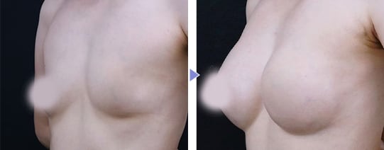 Motivaエルゴノミックス2 症例写真