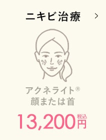 ニキビ治療