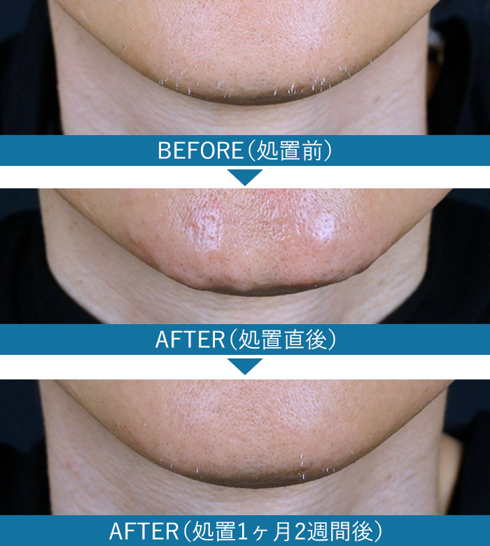 白髪の症例写真2