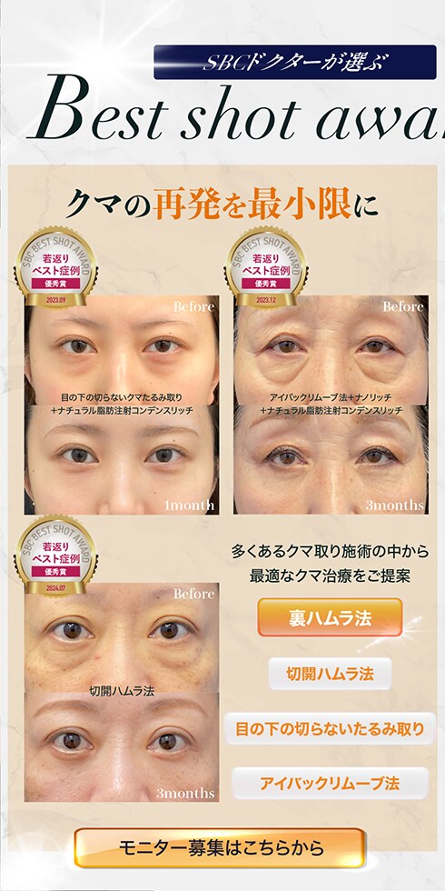 クマ取りモニター募集