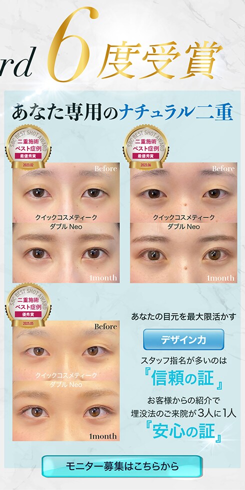 二重モニター募集