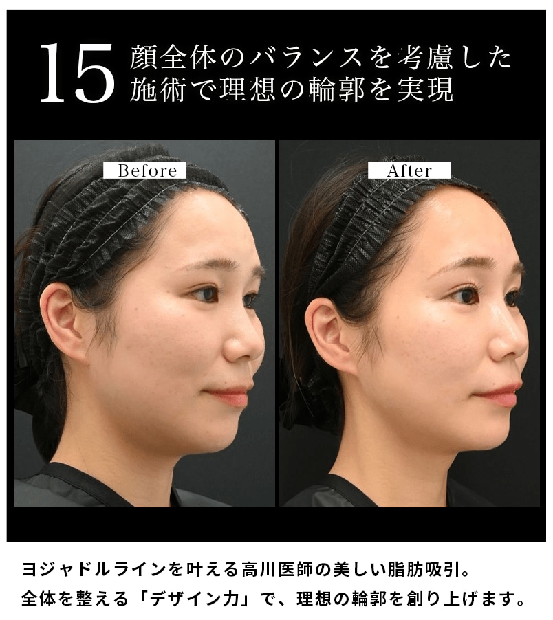 選ばれる理由