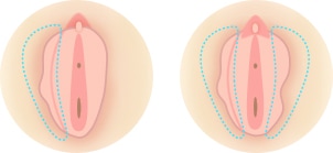 左右の形が違う イメージ
