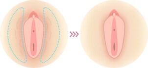 大陰唇がたるんでいる イメージ