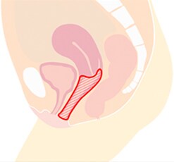 膣内全体 イメージ2