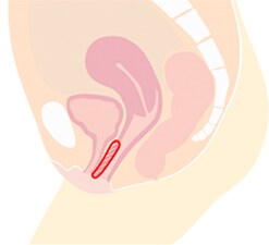 尿道周辺 イメージ2