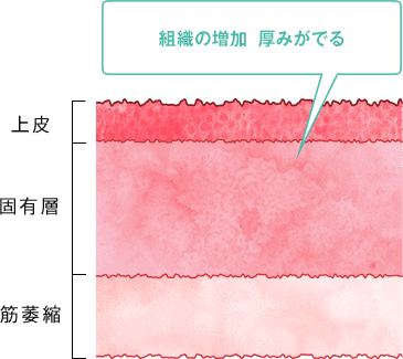 レーザー治療 After