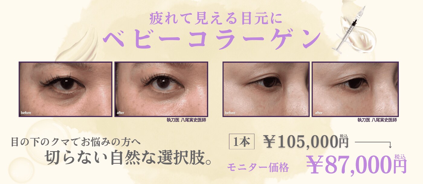 疲れて見える目元に ベビーコラーゲン