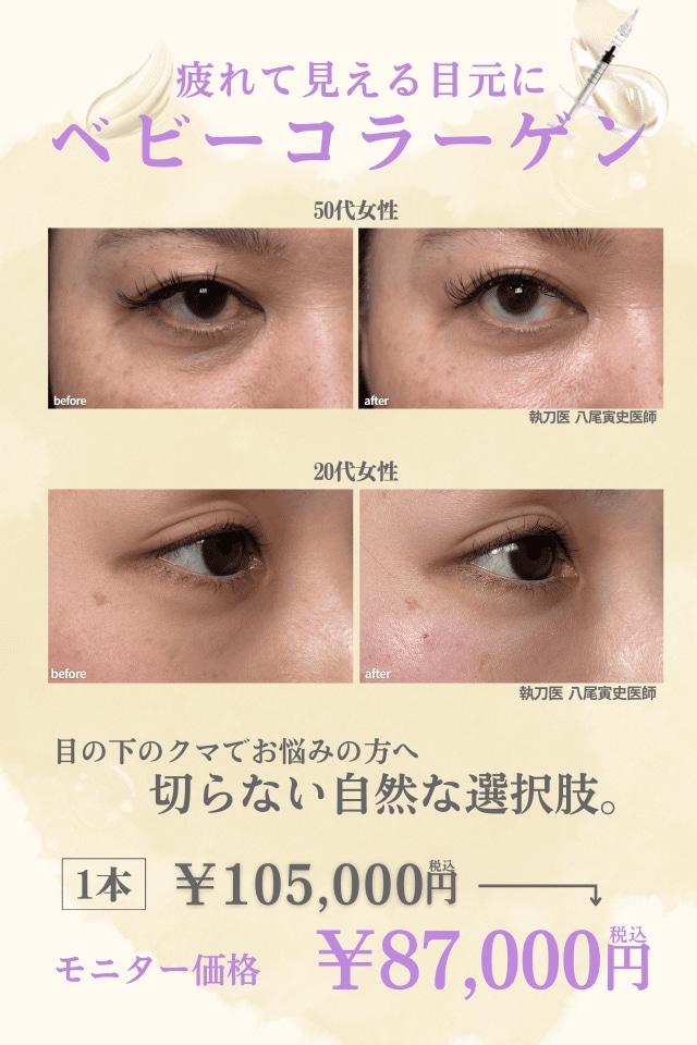 疲れて見える目元に ベビーコラーゲン