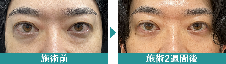 デンシティ 症例写真Before After