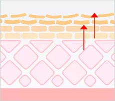 ケミカルピーリング イメージ2