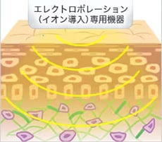 エレクトロポレーション(イオン導入) イメージ2