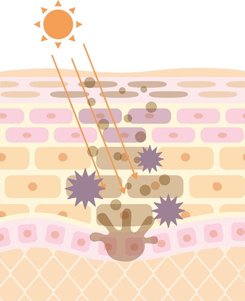 肌が老化する仕組み
