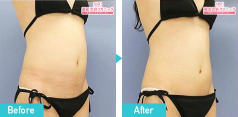 トゥルースカルプiD 症例写真 ビフォーアフター