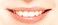 �C���v�����g