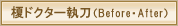 �|�h�N�^�[�����i�r�t�H�A�[�E�A�t�^�[�j