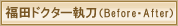 福田ドクター執刀(ビフォアー・アフター)