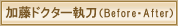 �����h�N�^�[�����i�r�t�H�A�[�E�A�t�^�[�j