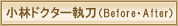 小林ドクター執刀(ビフォアー・アフター)
