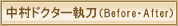 中村ドクター執刀(ビフォアー・アフター)