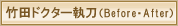 �|�c�h�N�^�[�����i�r�t�H�A�[�E�A�t�^�[�j