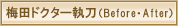 梅田ドクター執刀(ビフォアー・アフター)