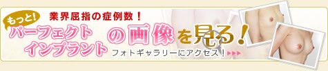 もっとパーフェクトインプラントの画像を見る!