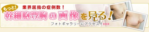 もっとパーフェクト脂肪幹細胞注入の画像を見る!