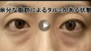 �ڂ̉��E���g�����X�@���j�^�[��W