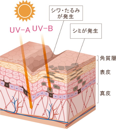 紫外線による光老化の構造