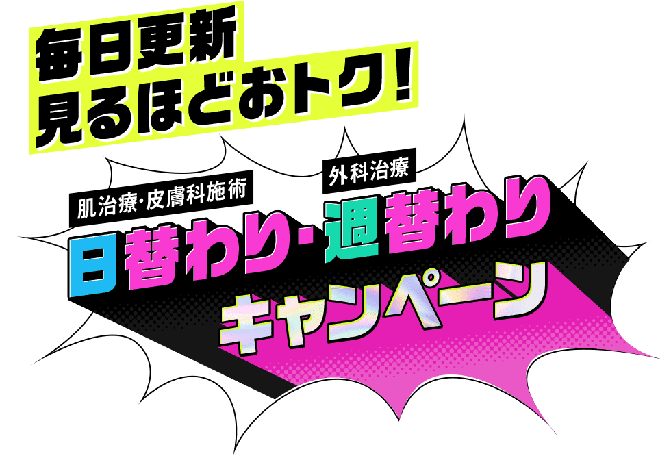 日替わり・週替わりキャンペーン