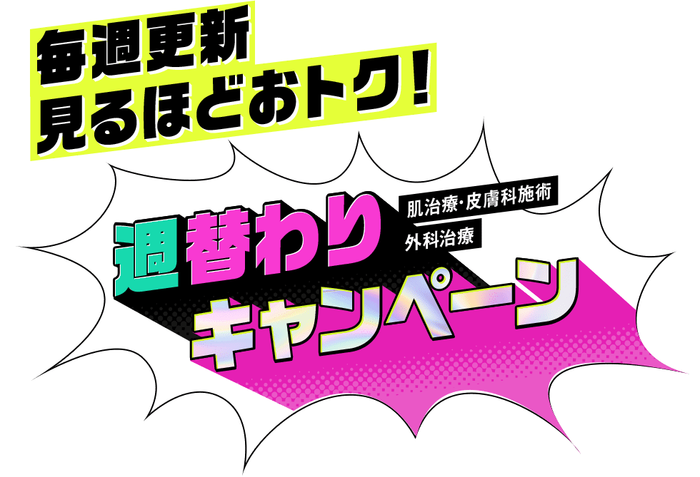 日替わり・週替わりキャンペーン