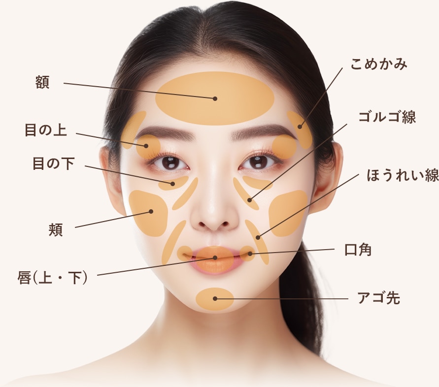 ナチュラル脂肪注射(お顔の脂肪注入)の対象部位