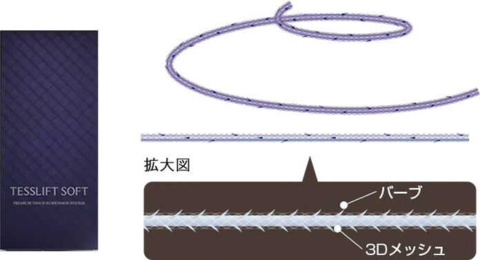 テスリフトの糸の特徴