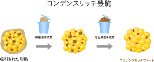 4倍以上の幹細胞群注入で、定着率が高い！イメージ2