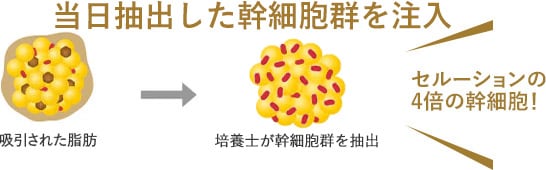 4倍以上の幹細胞群注入で、定着率が高い！イメージ3