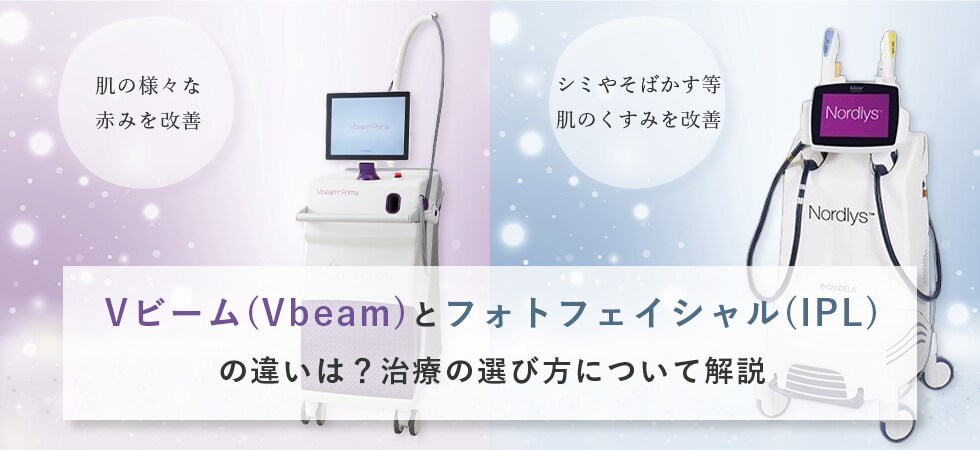 Vbeam prima（Vビームプリマ）