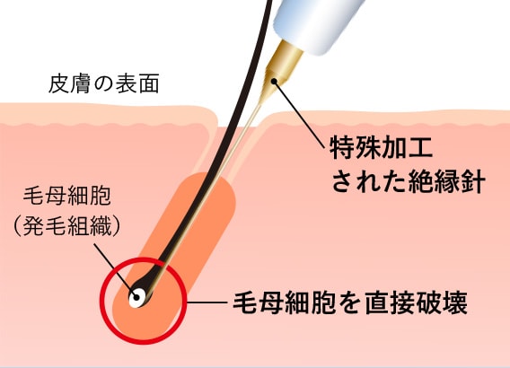 仕組みイメージ