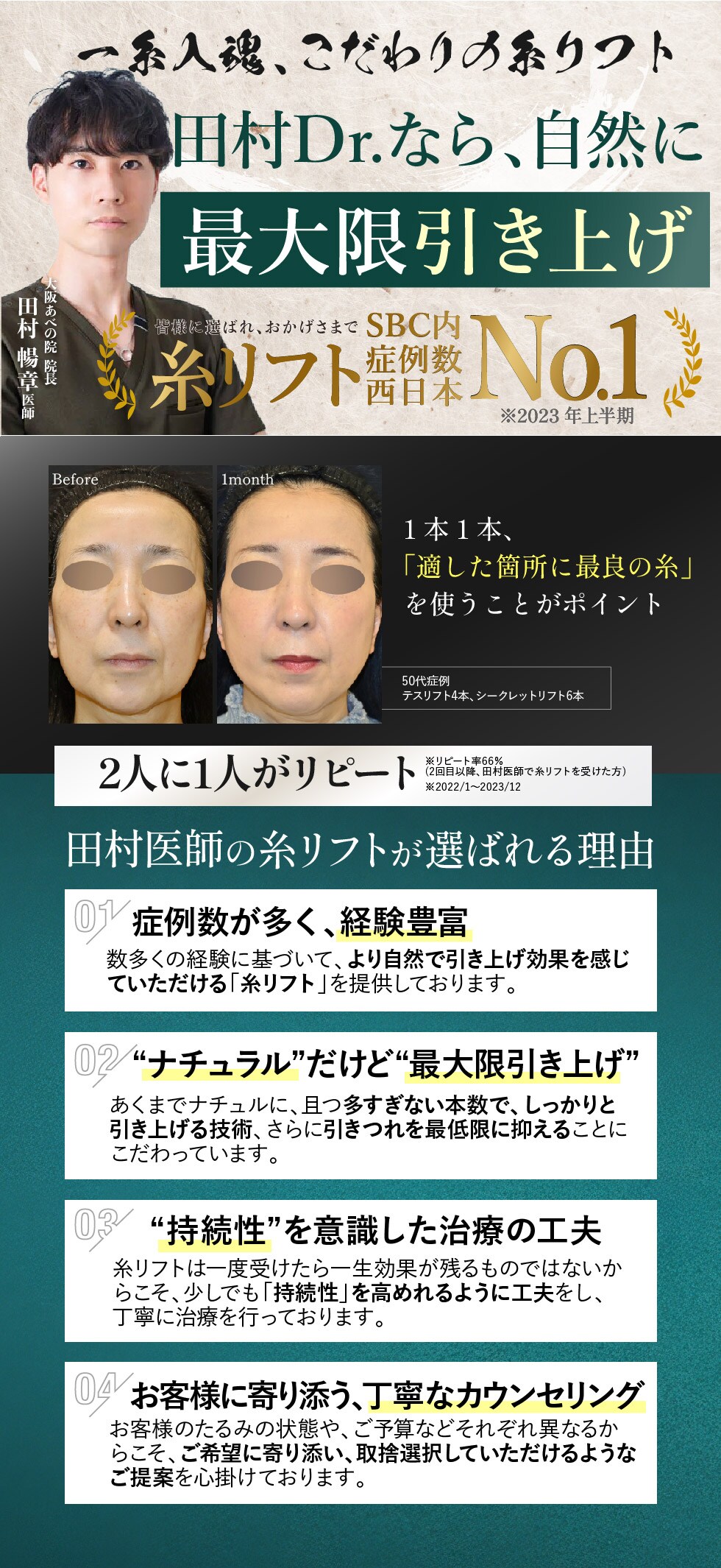 糸リフト症例数