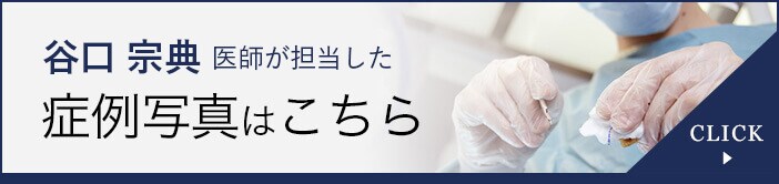 谷口宗典医師が担当した症例写真はこちら