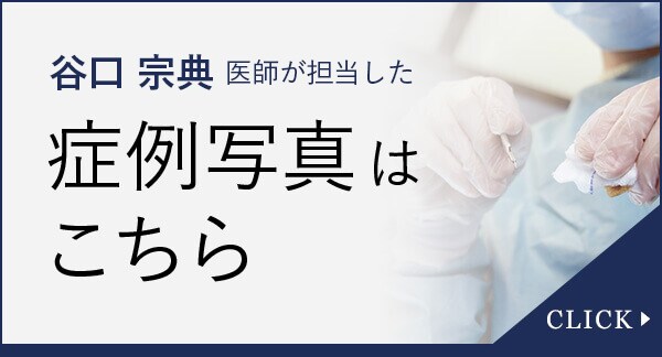 谷口宗典医師が担当した症例写真はこちら