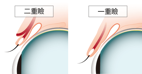 二重瞼と一重瞼の構造の違い